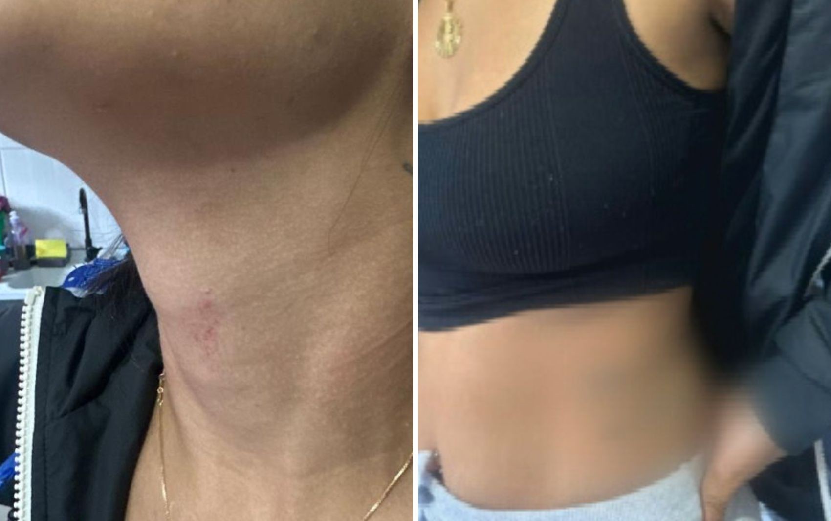 Mulher agredida por ex-companheiro liga para a PM fingindo que queria pizza para pedir socorro, diz polícia