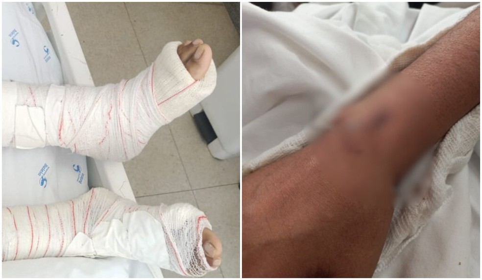 Vítima ficou internada por 12 dias — Foto: Arquivo pessoal
