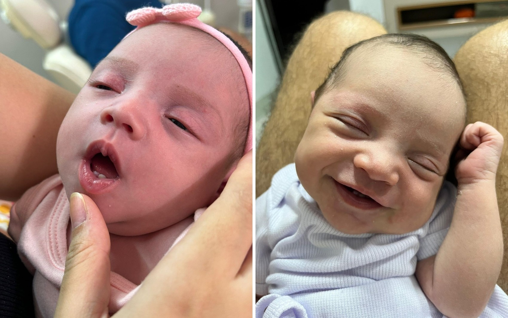 Bebê nasce com dentinhos e surpreende pais: 'Vi assim que ela chorou'