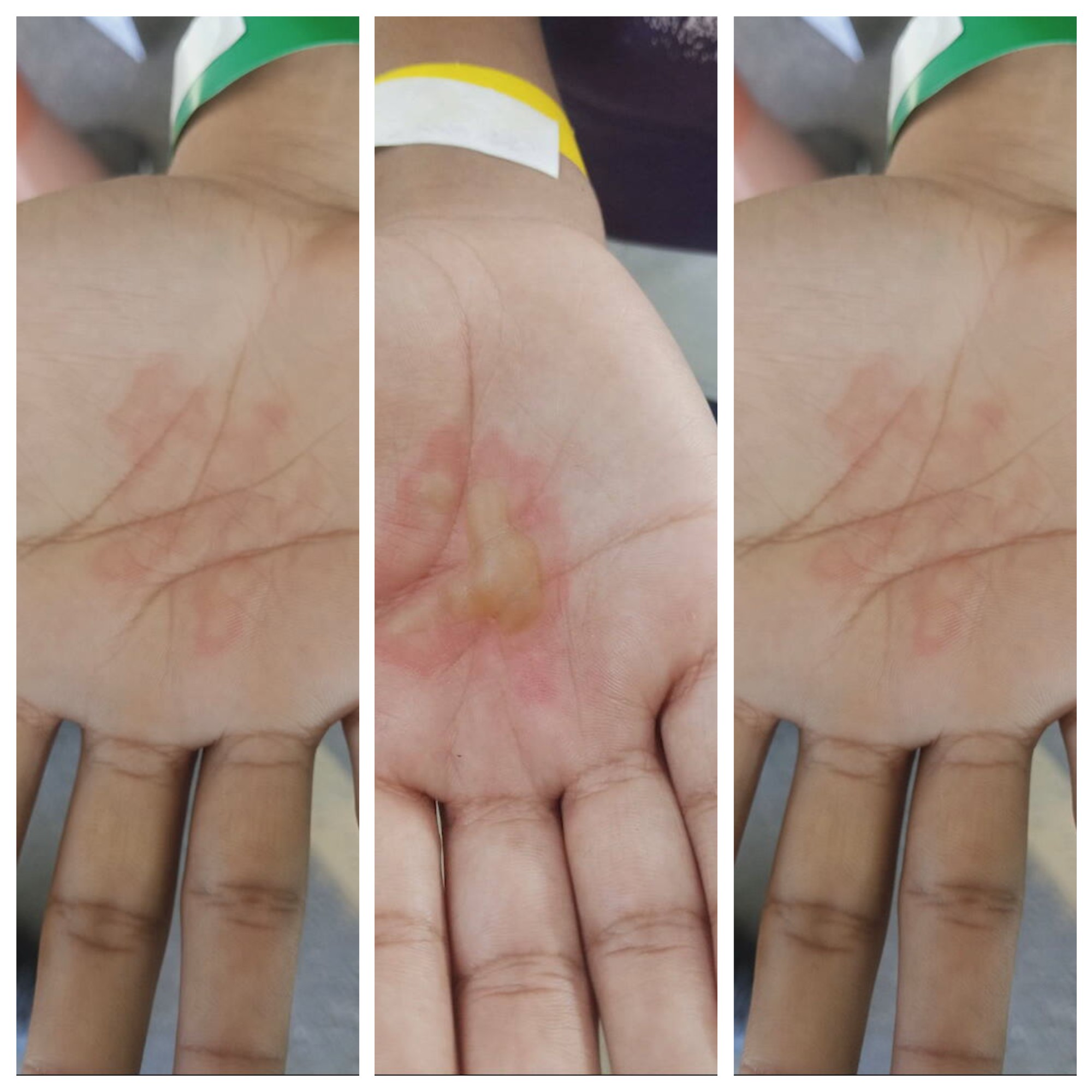 Pai é preso suspeito de torturar os três filhos com comida fervendo na Grande BH