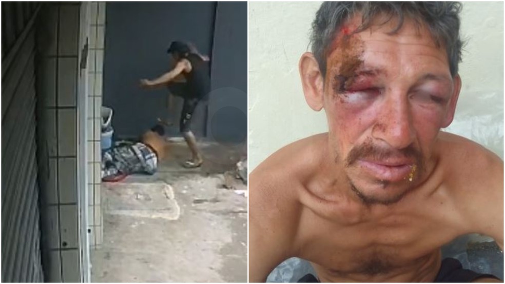 Homem em situação de rua ficou com vários ferimentos no rosto após ser agredido. — Foto: Reprodução
