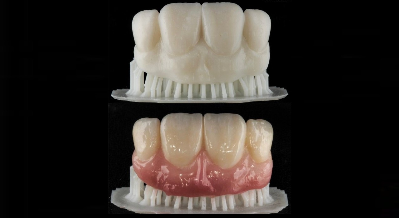 Unidades odontológicas móveis vão produzir próteses dentárias com impressora 3D; entenda 