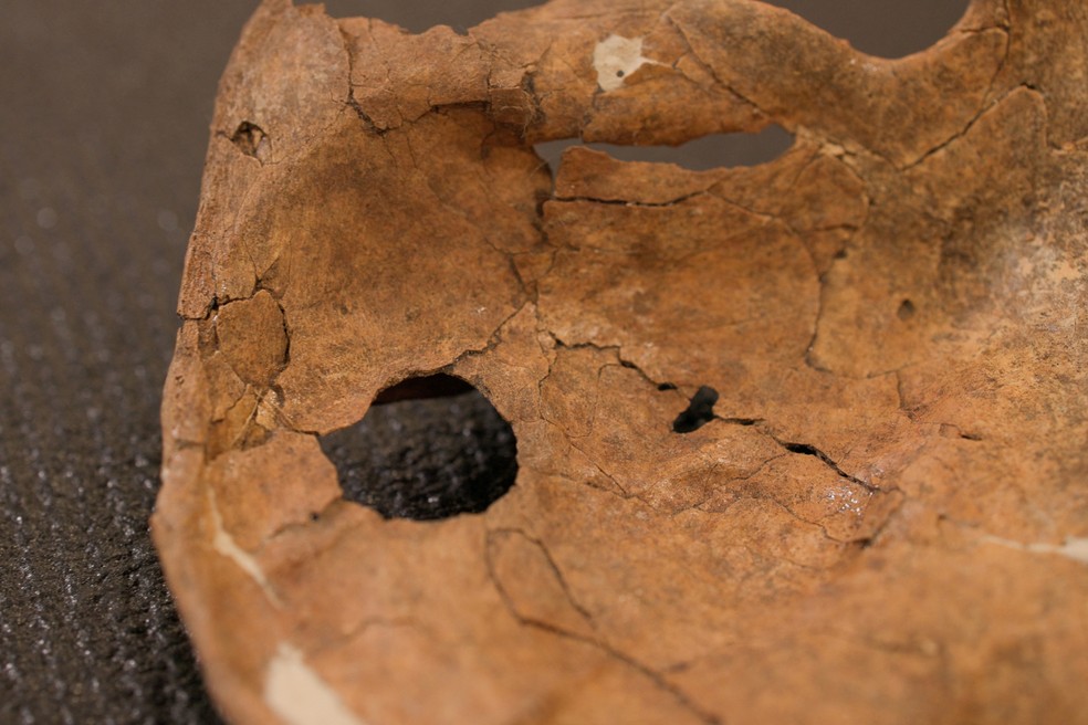 Escápula esquerda de um Neanderthal que teria morrido por causa de uma lança 75 mil anos atrás. — Foto: University of Cambridge via Reuters