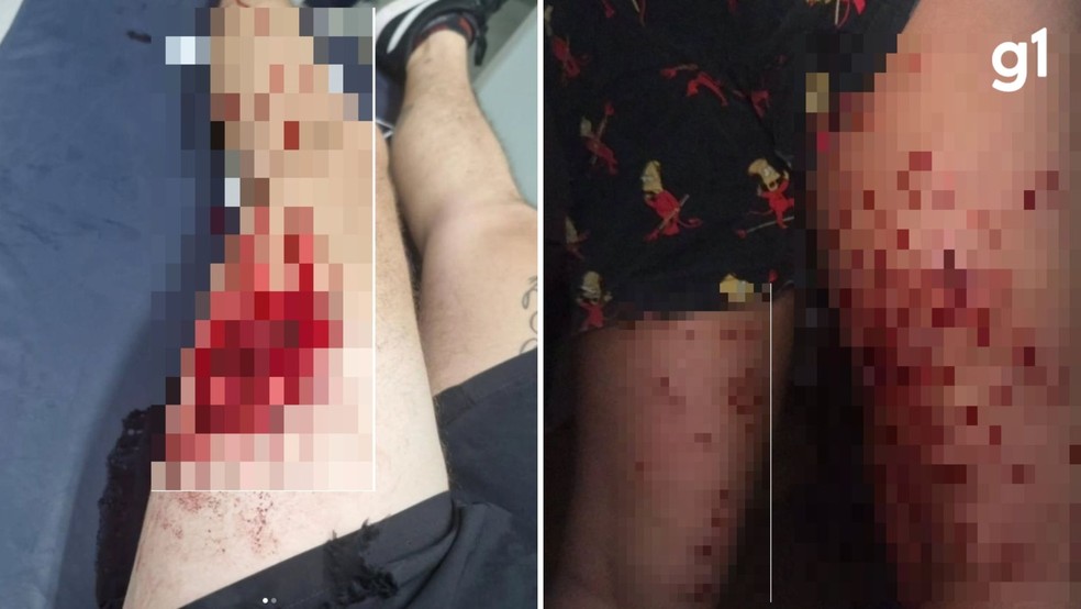Imagens mostram ferimentos que folies sofreram aps ao da Brigada Militar durante Carnaval em Porto Alegre — Foto: Arquivo pessoal