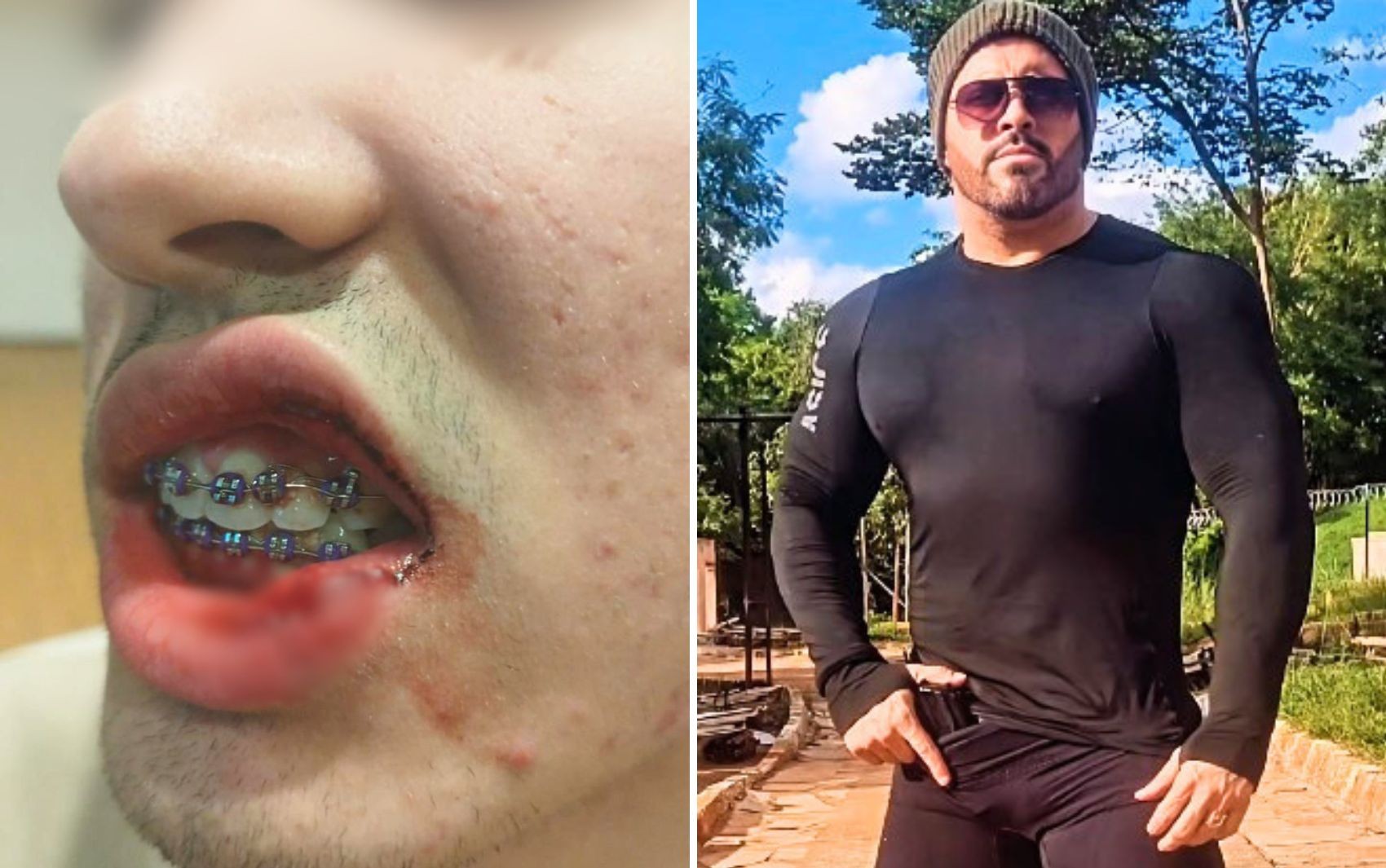 Lutador que espancou adolescente até desmaiar já deu socos na boca de outros dois jovens, diz mãe: ‘Ele precisa ser parado’ 