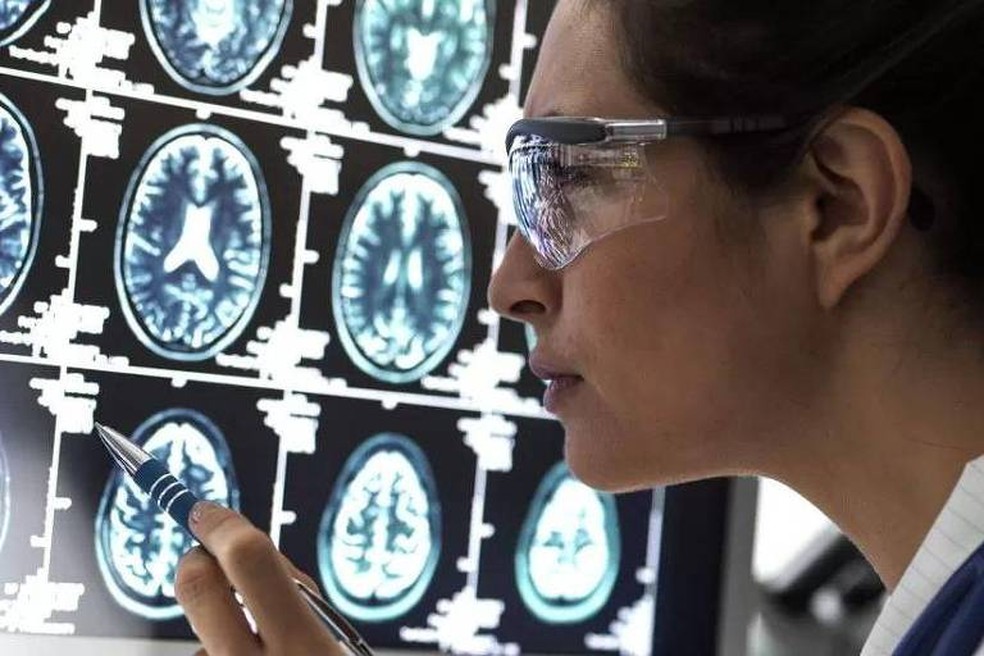 Pesquisadores acreditam que descobertas dão novas ideias para o tratamento da doença de Alzheimer — Foto: GETTY iMAGES via BBC