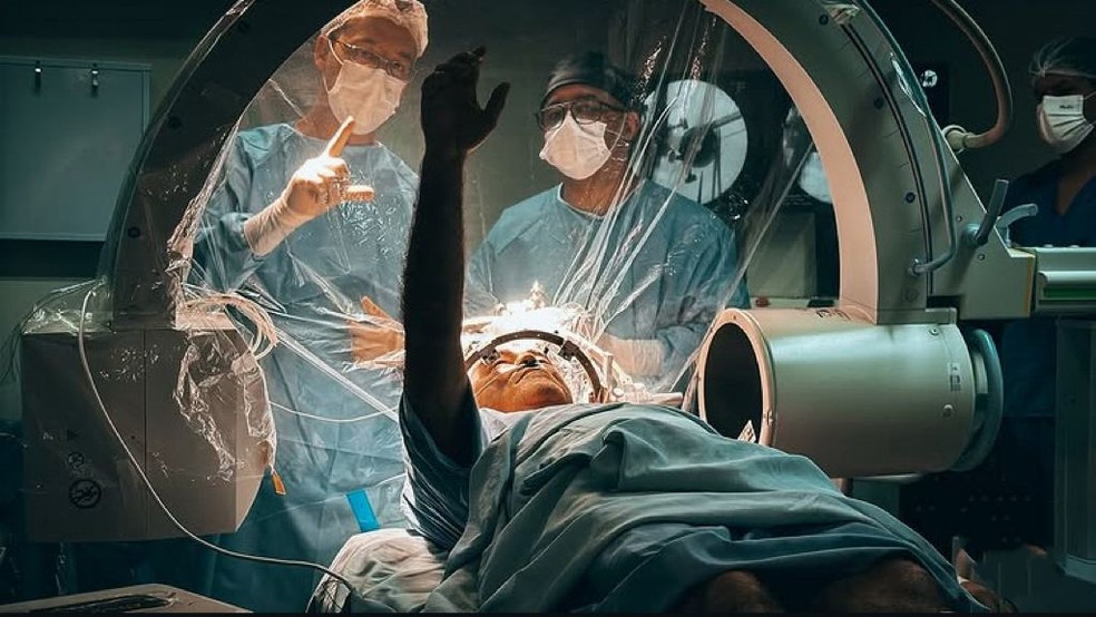 Paciente abre a mão durante cirurgia de Parkinson em Rondônia — Foto: Reprodução