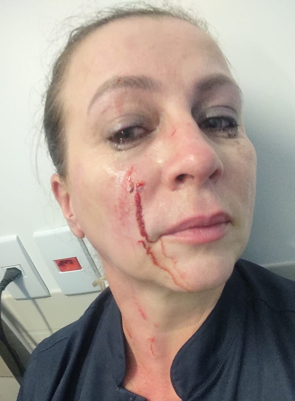 Karina Valverde, técnica de enfermagem, foi agredida por acompanhante de paciente durante o trabalho — Foto: Arquivo Pessoal