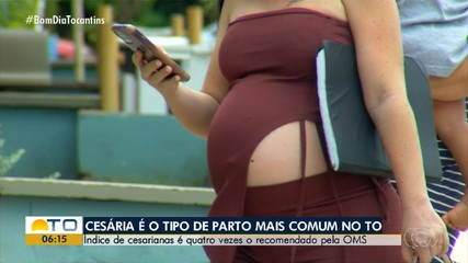 Ministério Público sugere que cesarianas sejam realizadas apenas com indicação médica