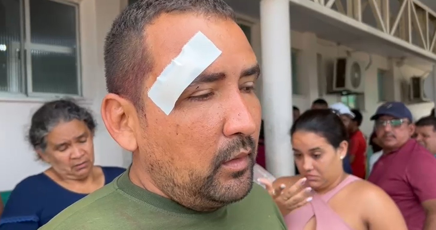 Sobrevivente de acidente na AM-010 diz que motorista de caminhão pediu desculpas antes de morrer: 'estava sob efeito de bebidas alcoólicas'