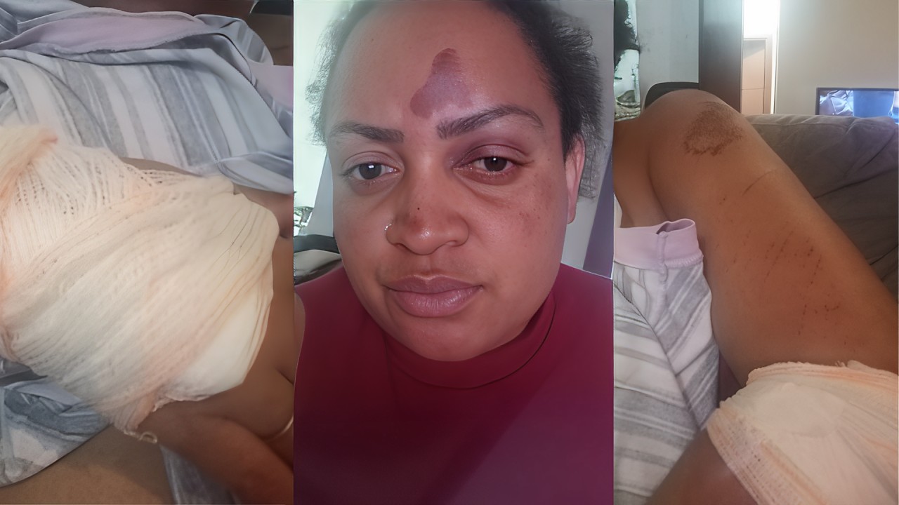 Mulher é arrastada por motorista de aplicativo após falha em máquina de cartão: 'Tudo isso por R$ 10'