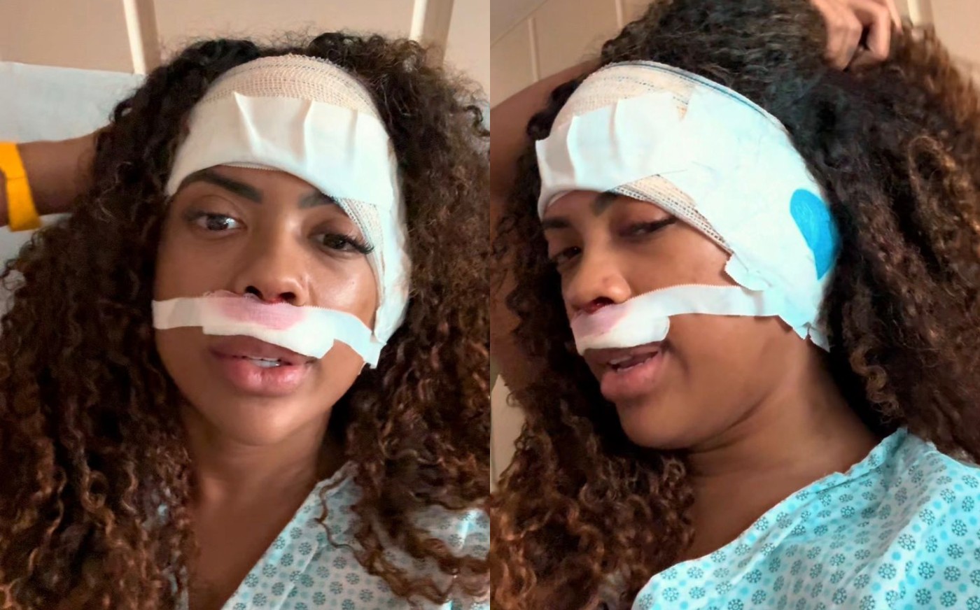 Marvvila volta aos palcos após retirar tumor no ouvido: ‘Sentia dor até para colocar fone’