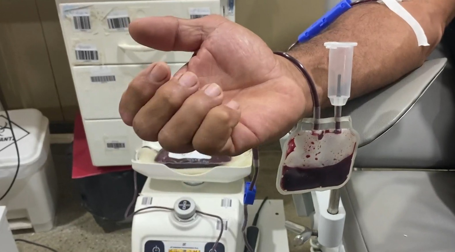 Estoque de três tipos sanguíneos zera e Hemocentro de Mossoró convoca doadores; saiba quem pode doar