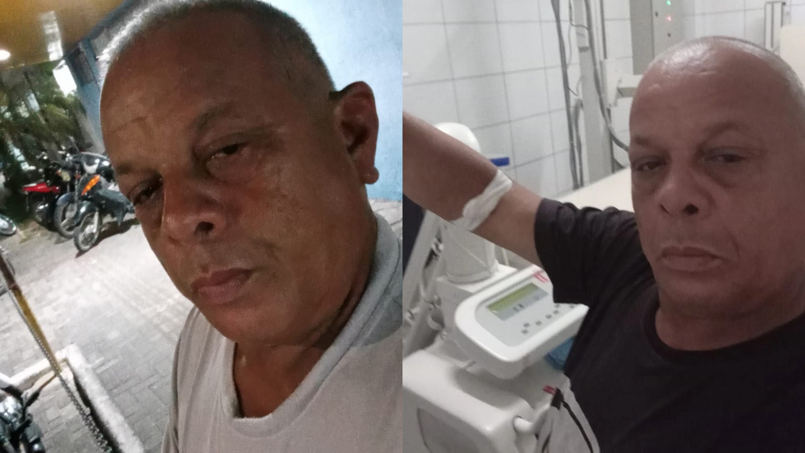 Policial militar morre seis dias após ser baleado na cabeça em Teresina