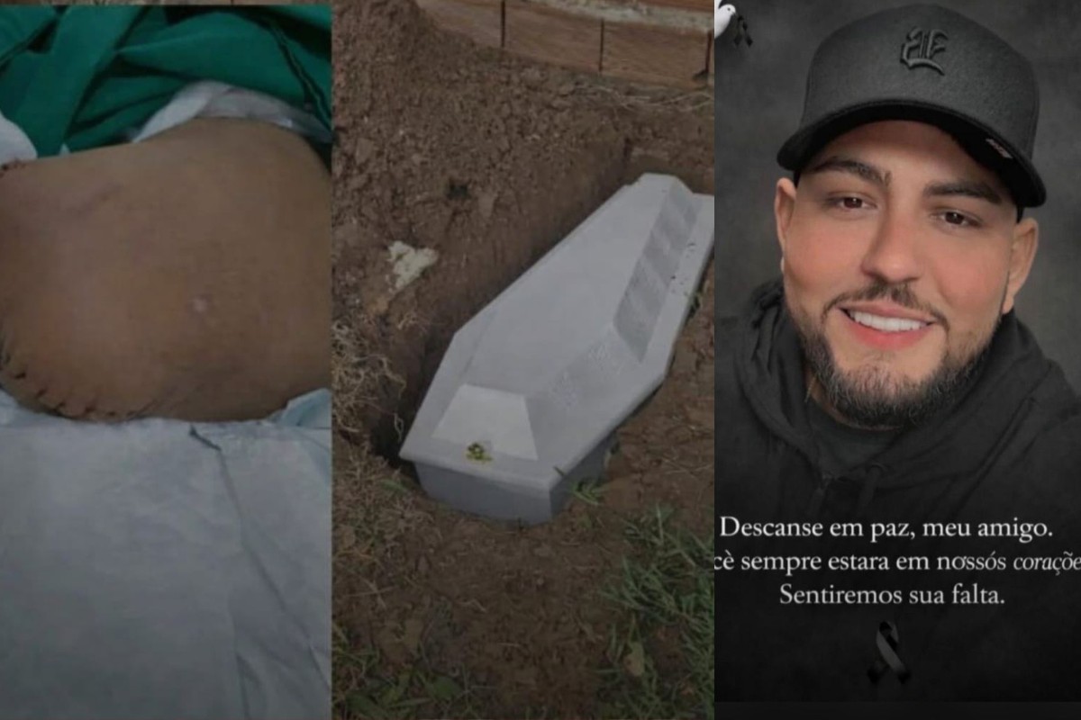 Família faz dois enterros de filho após hospital esquecer perna amputada em MT