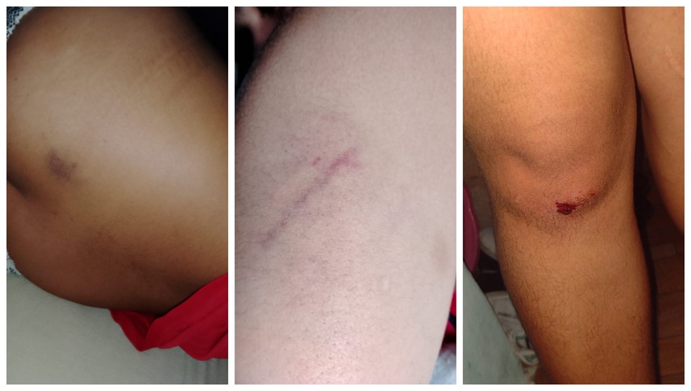Mulher fica ferida após ser agredida por PM no Metrô — Foto: Arquivo pessoal