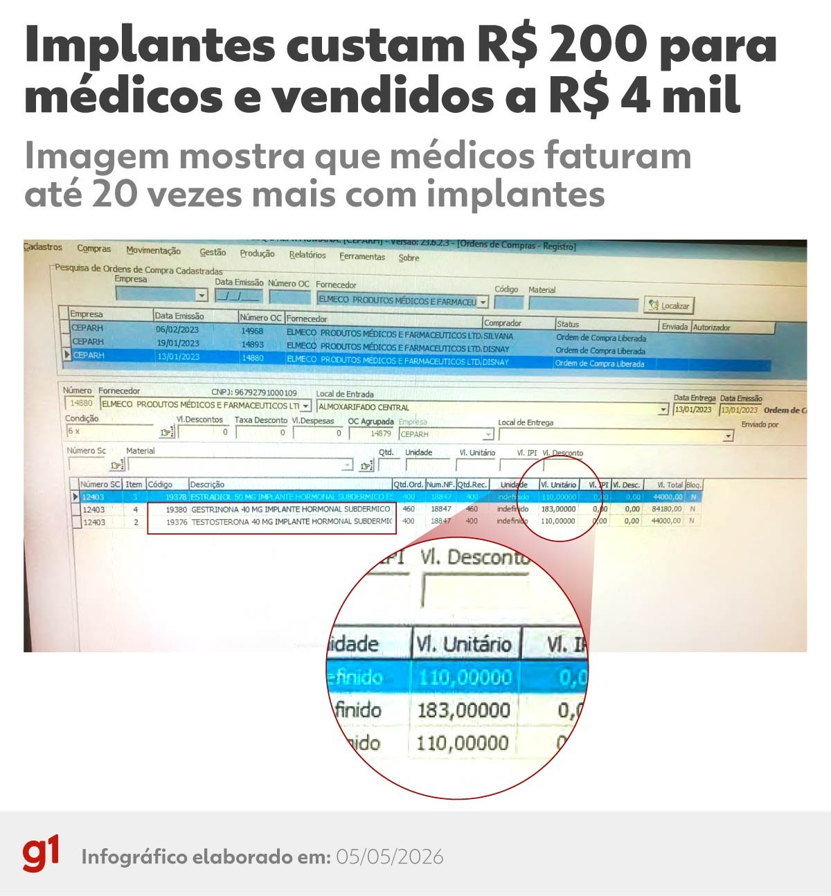 Médicos driblam proibição e lucram com implantes hormonais irregulares