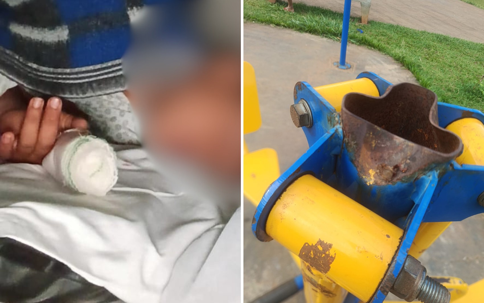 Criança tem parte do dedo amputada após acidente em aparelho de ginástica de praça, diz mãe