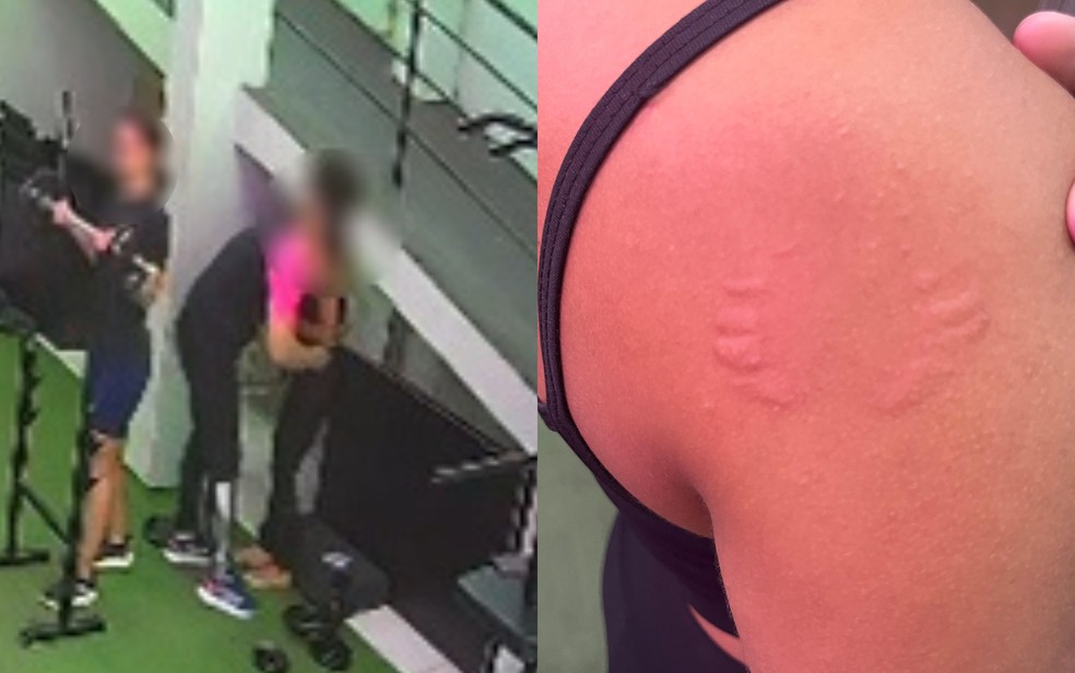 Instrutor de academia nega assédio e diz que mordida em aluna foi 'brincadeira'