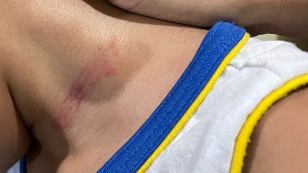 Criança com autismo agredida em escola ficou com marcas no pescoço — Foto: Reprodução