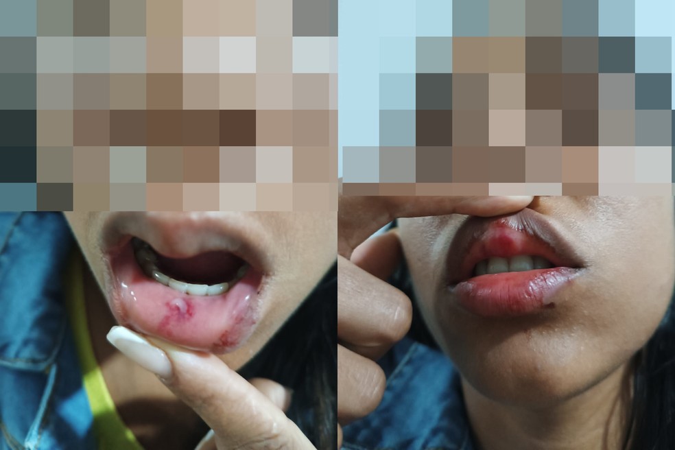 Mulher mostra ferimentos provocados pelo marido, Goiás — Foto: Divulgação/PM