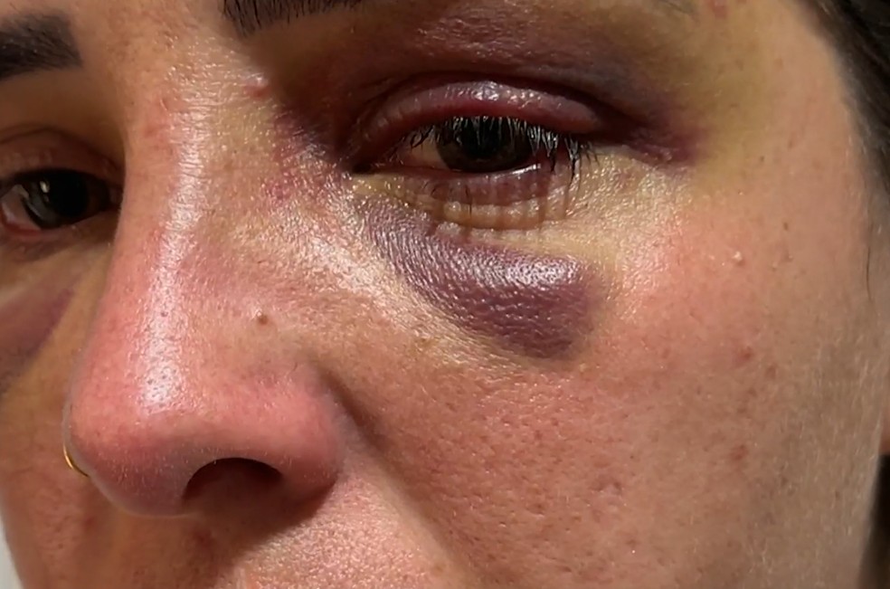 Mulher é atacada pelo ex enquanto ia à delegacia denunciá-lo por agressões, em São José dos Campos — Foto: Reprodução/TV Vanguarda