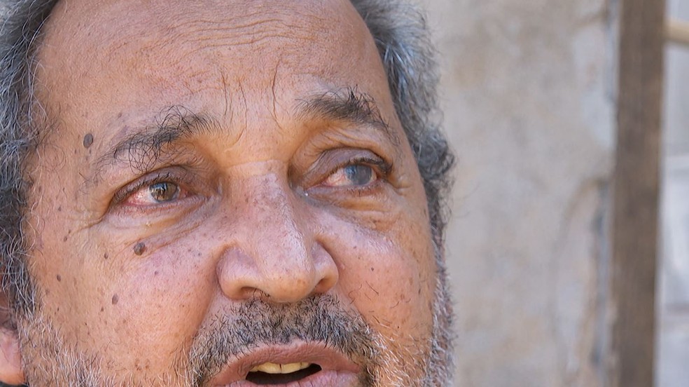 O pintor Carlos Augusto Rinaldi perdeu a visão do olho esquerdo após passar por cirurgia de catarata no AME de Taquaritinga, SP — Foto: Valdinei Malaguti/EPTV
