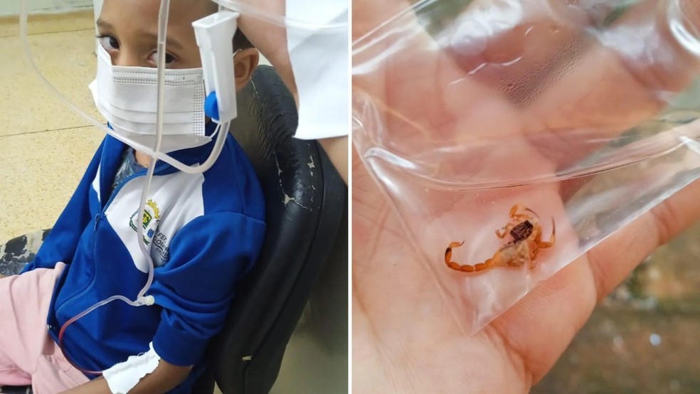 De acordo com a mãe, escorpião era pequeno por isso não teve um desfecho pior — Foto: Divulgação / Arquivos Pessoais