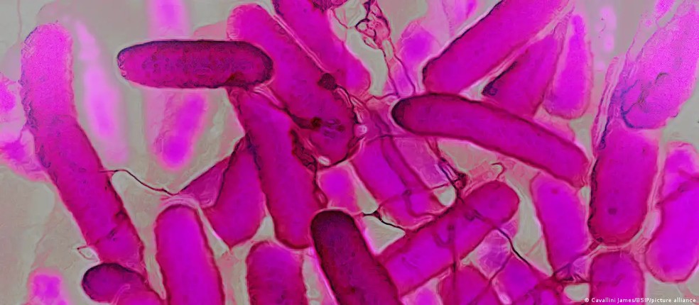 Bactérias Escherichia coli coloridas no microscópio eletrônico: uma das responsáveis pela síndrome — Foto: Cavallini James/BSIP/picture alliance via DW