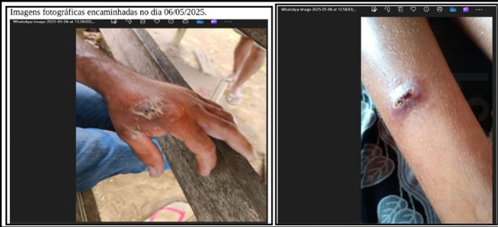 Indígenas intoxicados por agrotóxicos em RO — Foto: MPF