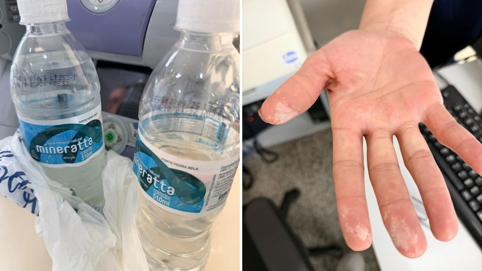 Polícia investiga possível contaminação em água após homem passar mal no interior de SP — Foto: Polícia Civil de Garça/reprodução