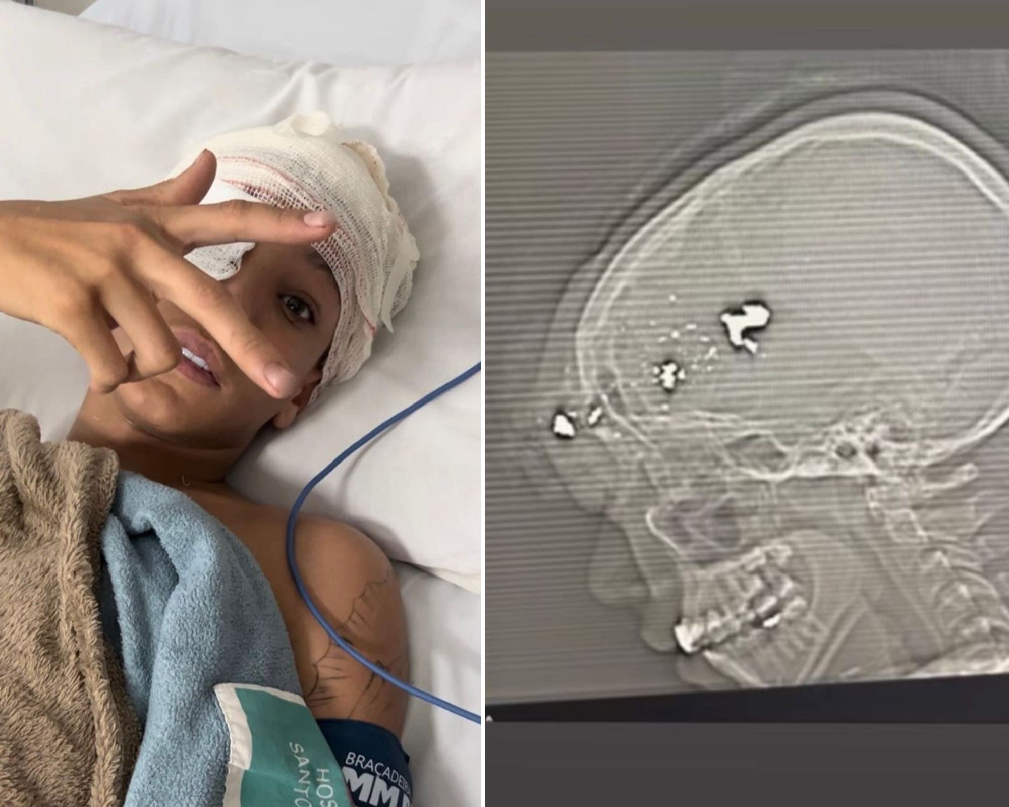 Antes de alcançar 7 milhões de seguidores e ser preso, Meno Kabrinha sobreviveu a tiro e queda