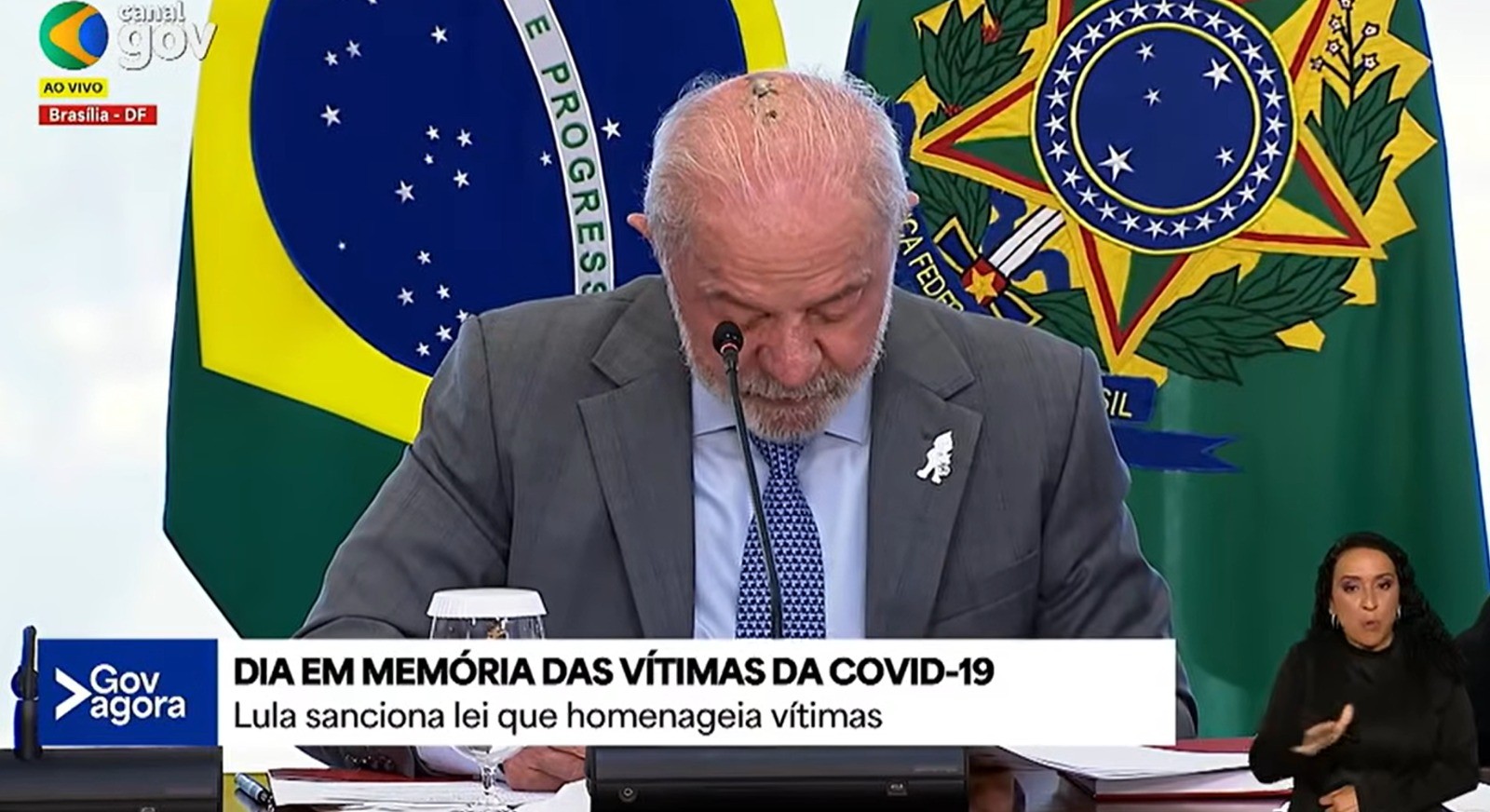 Lula faz novo procedimento de radioterapia no couro cabeludo
