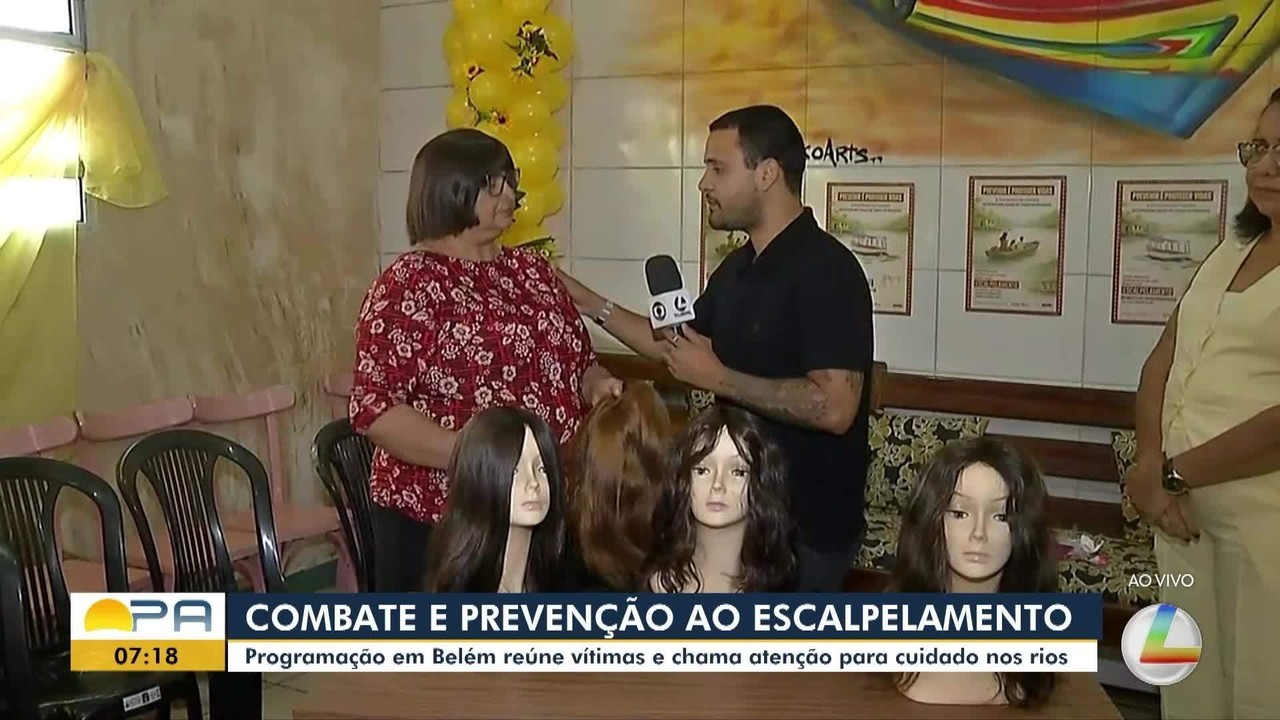 Dia de combate ao escalpelamento tem programação na Grande Belém