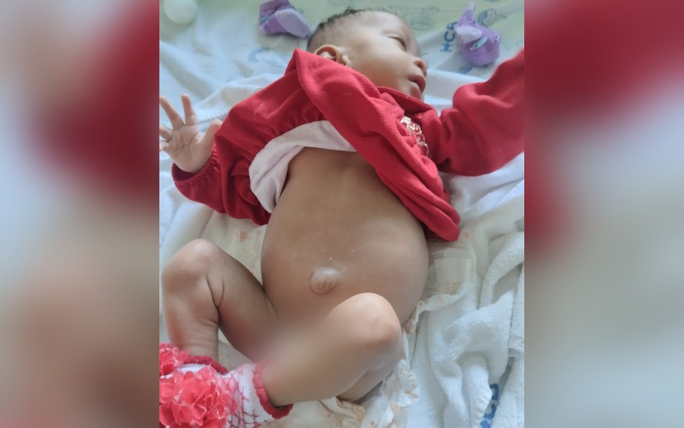 Isis Eloah Ferreira Alves, de 1 ano e 1 mês, nasceu com quatro rins — Foto: Arquivo pessoal/Thalia Silva Alves