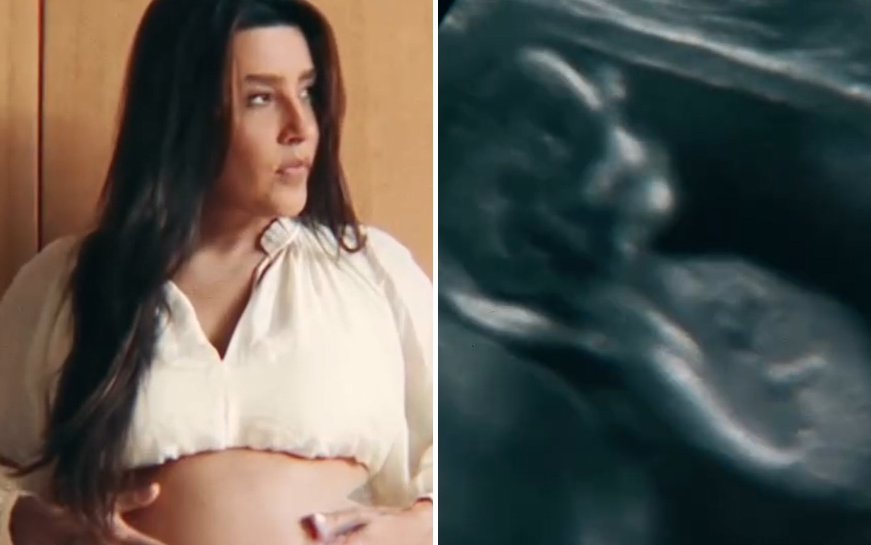 Luauna Prado anuncia gravidez: ‘Minha vida ganhou um novo sentido’ 