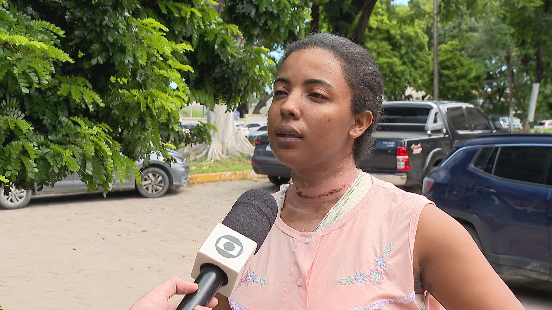 Mulher esfaqueada e queimada por ex-colega de trabalho conseguiu lutar com agressor por praticar artes marciais: 'Perguntou se eu ia namorar com ele'