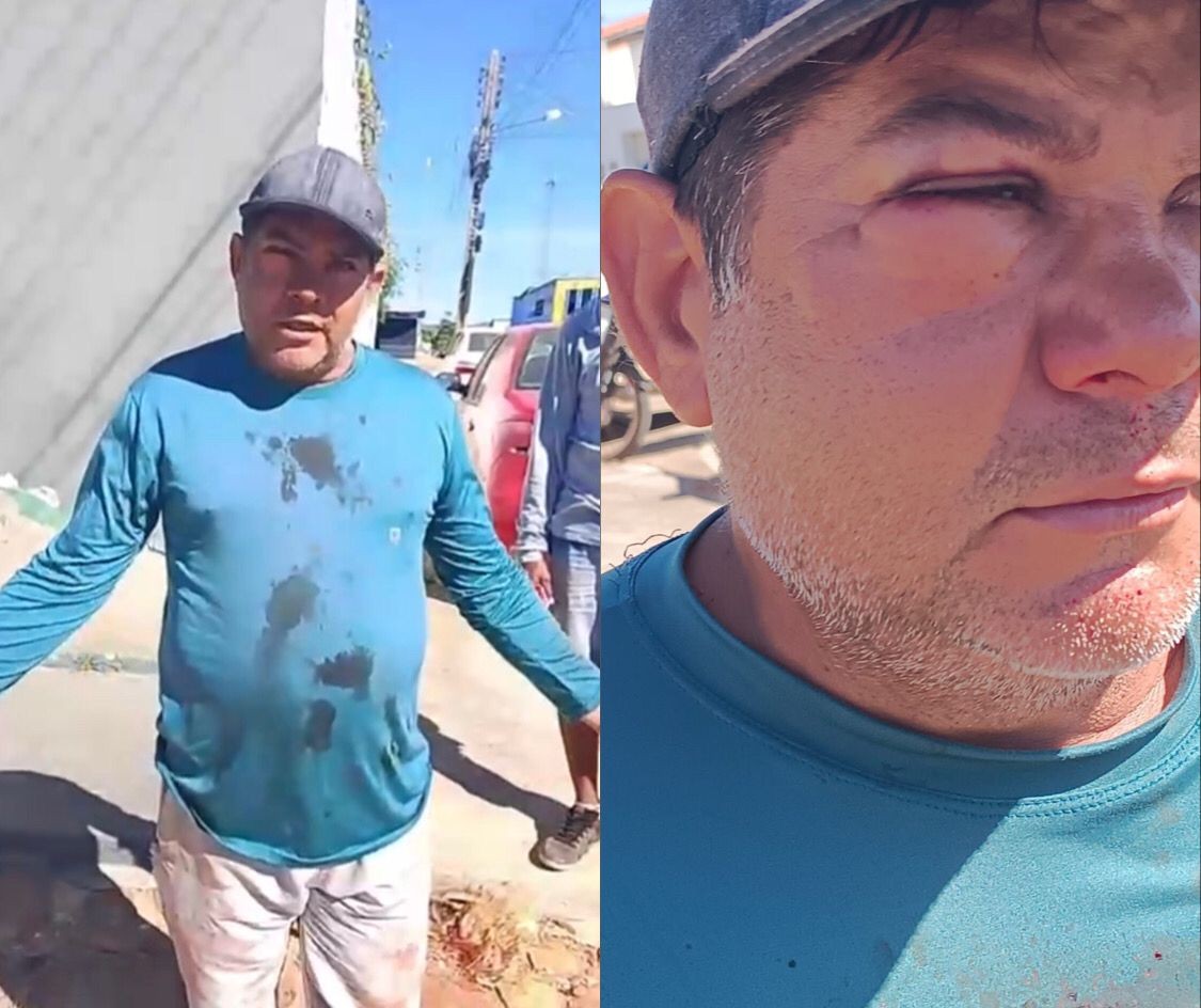 Ex-vereador acusado de agredir servidor da prefeitura de São Raimundo Nonato vai usar tornozeleira eletrônica 