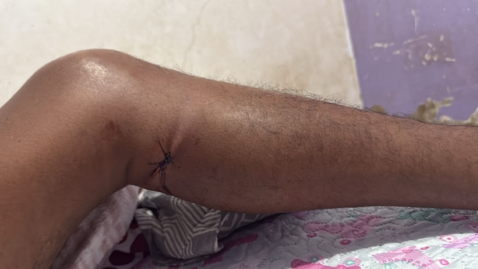 Policial civil atira em garimpeiro durante briga em posto de combustíveis em Boa Vista