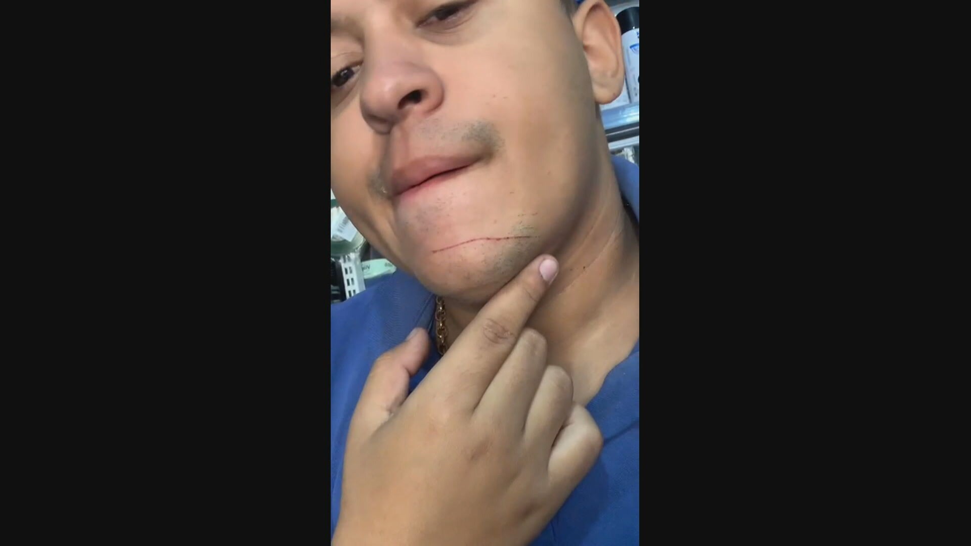 Motociclista escapa por pouco de ferimento grave com linha chilena: ‘Senti um arranhão no meu pescoço’