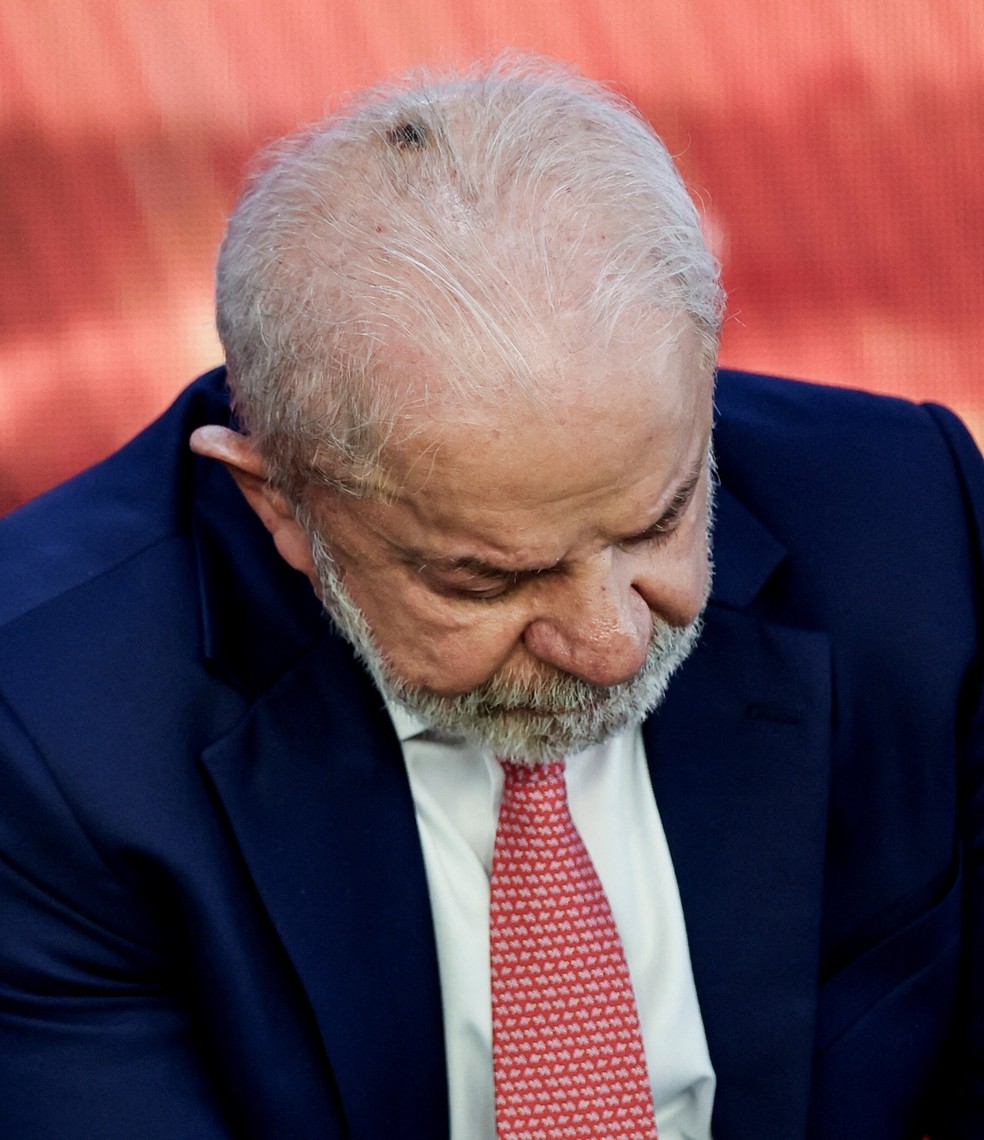 Lula aparece com mancha na cabeça após procedimento para retirar acúmulo de pele — Foto: Mateus Bonomi/Reuters
