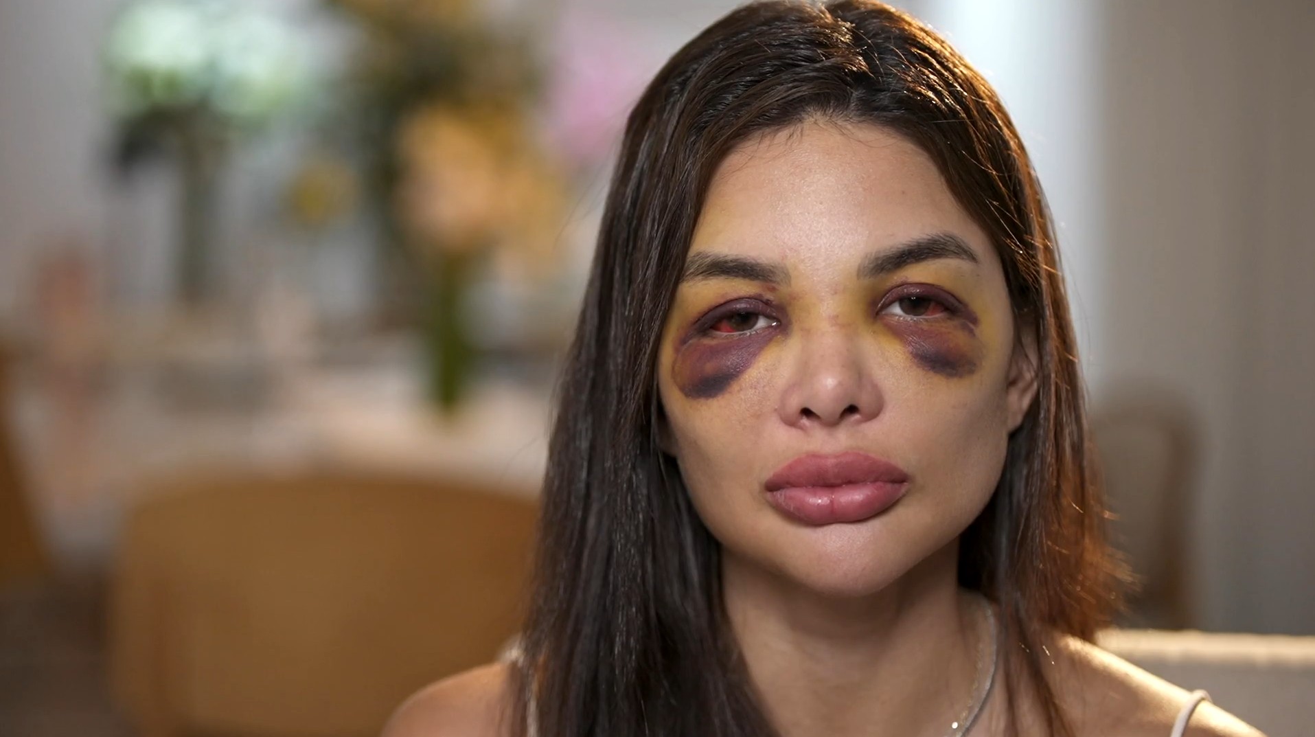 'Acreditava que era ódio isolado': mulheres vítimas de violência podem levar mais de 10 anos para sair de relacionamentos abusivos