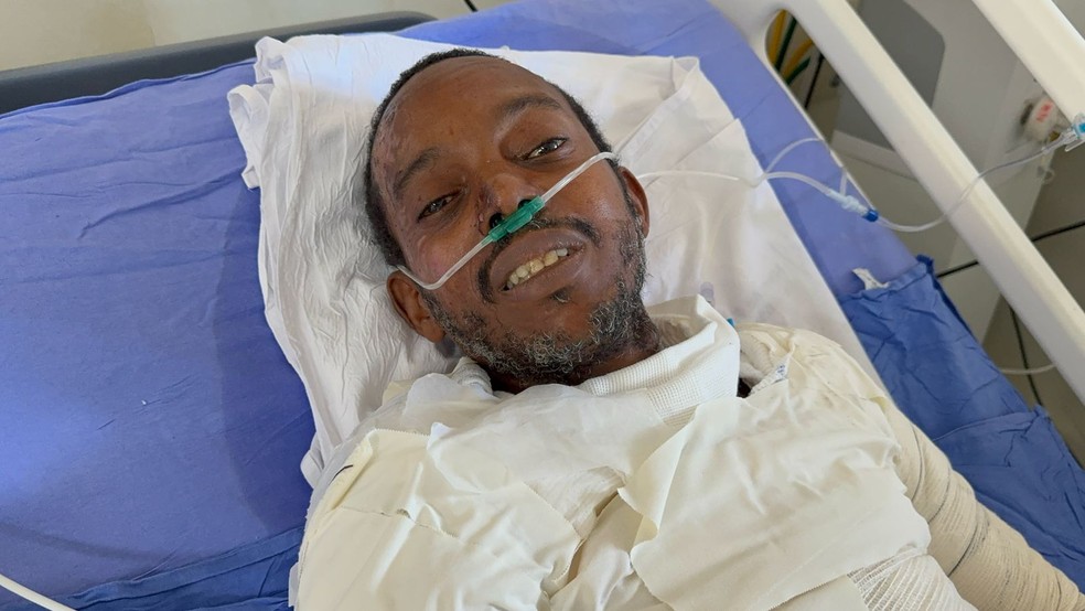 'Eu só escutei o barulho e senti todo o meu corpo queimando', diz Ludierley — Foto: Rafael Nascimento/g1