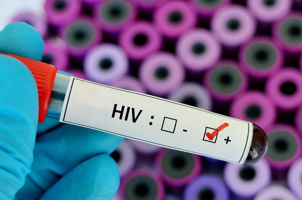 Para esclarecer: o termo HIV é usado para se referir ao vírus da imunodeficiência humana. Já AIDS significa síndrome da imunodeficiência adquirida. Ou seja, HIV é um vírus e AIDS é uma síndrome que pode ser desenvolvida por pessoas portadoras desse vírus — Foto: shutterstock