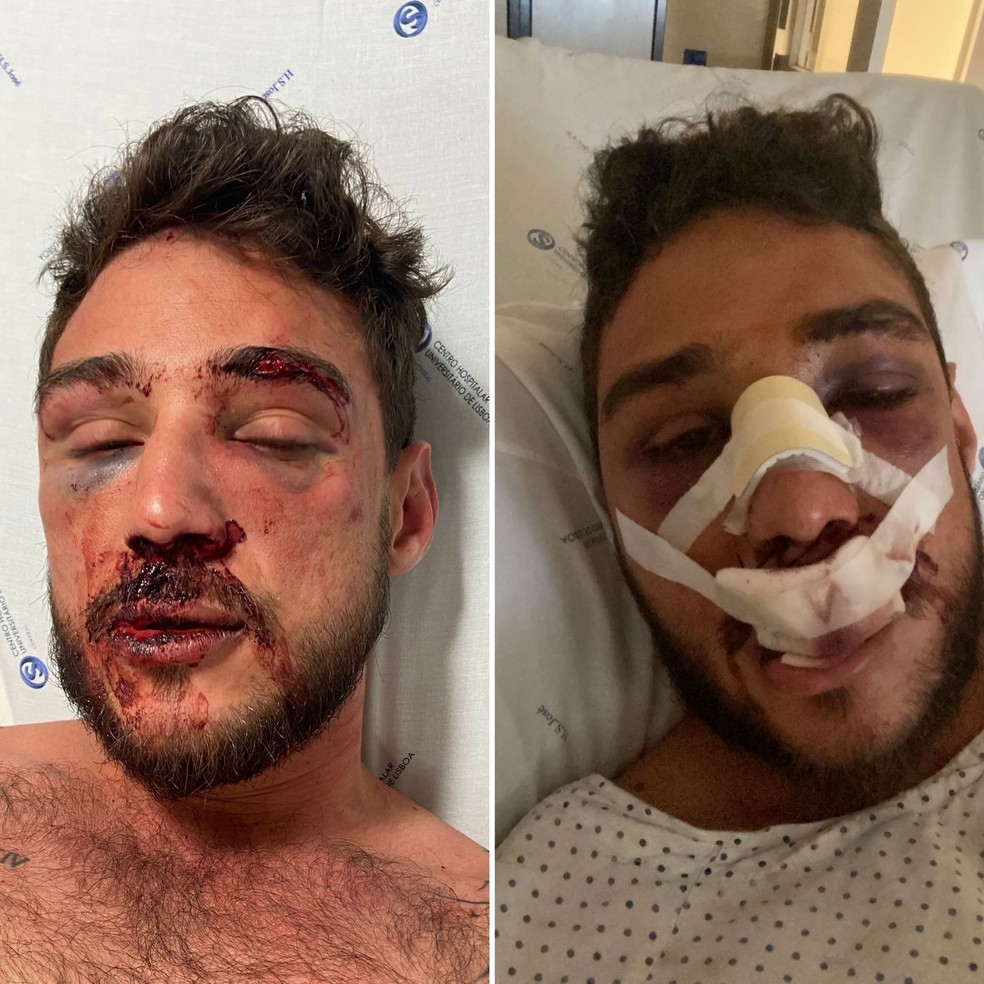 Jefferson passou por cirurgia e ficou dias internado em hospital — Foto: Arquivo pessoal