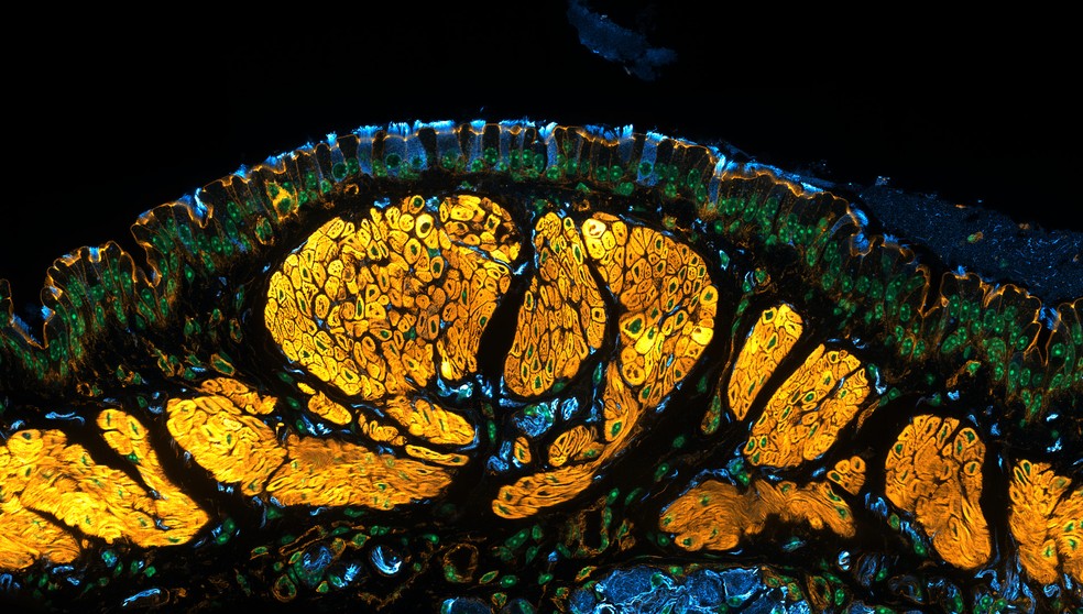 15º lugar: Traqueia de camundongo mostra pequenas estruturas semelhantes a pelos, além de nervos e músculos. — Foto: Julien Resseguier/Nikon Small World