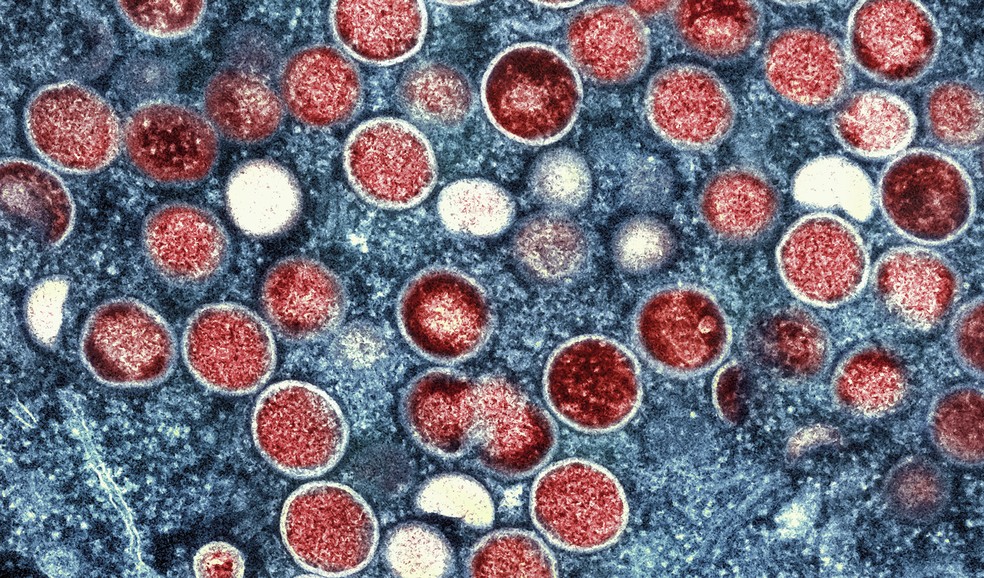 Vírus da monkeypox visto usando microscopia. — Foto: NIAID via AP, File