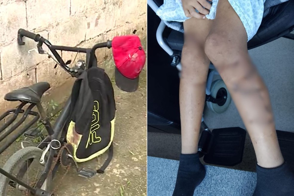 Menino de 12 anos estava andando de bicicleta quando foi surpreendido pelos cães da raça pit bull — Foto: Rinaldo Rori/TV Tribuna e Arquivo Pessoal