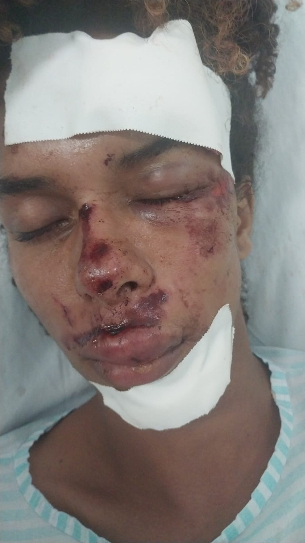 Jovem de 21 anos fica com rosto desfigurado após agressões no interior da Bahia — Foto: Arquivo pessoal