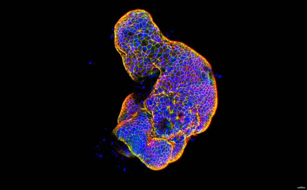 17º lugar: Tecido intestinal humano cultivado em laboratório mostra as conexões entre as células que formam sua barreira de proteção. — Foto: Gauri Kulkarni/Nikon Small World